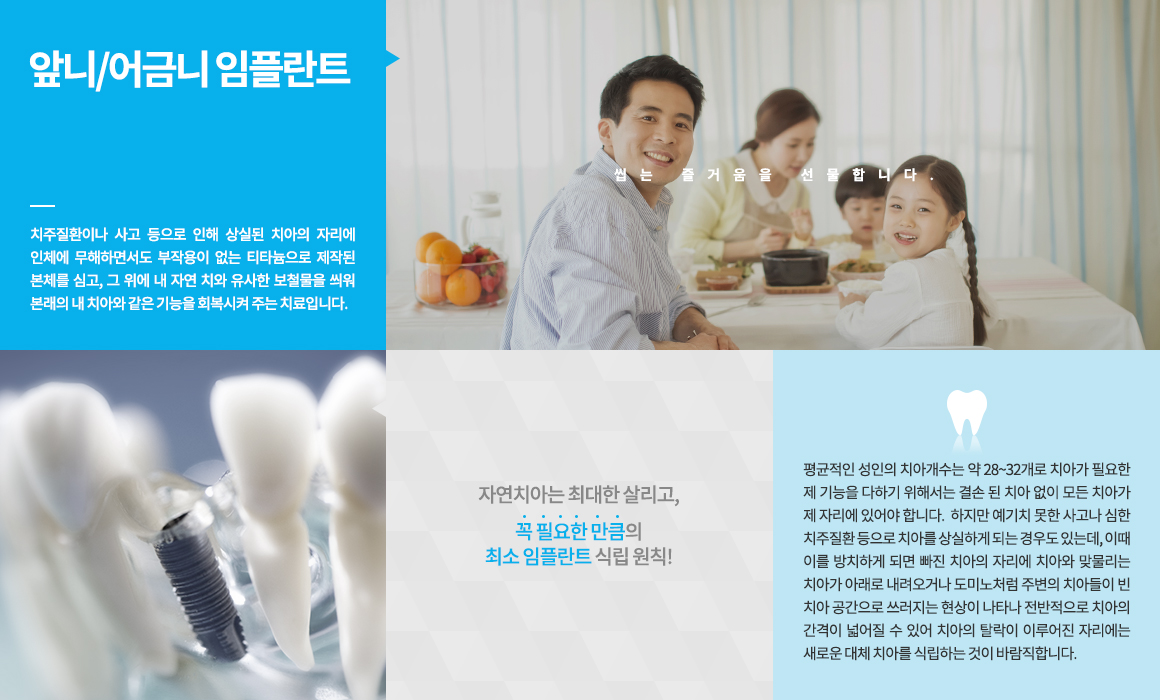 평균적인 성인의 치아개수는 약 28~32개로 치아가 필요한 제 기능을 다하기 위해서는 결손 된 치아 없이 모든 치아가 제 자리에 있어야 합니다. 하지만 예기치 못한 사고나 심한 치주질환 등으로 치아를 상실하게 되는 경우도 있는데, 이때 이를 방치하게 되면 빠진 치아의 자리에 치아와 맞물리는 치아가 아래로 내려오거나 도미노처럼 주변의 치아들이 빈 치아 공간으로 쓰러지는 현상이 나타나 전반적으로 치아의 간격이 넓어질 수 있어 치아의 탈락이 이루어진 자리에는 새로운 대체 치아를 식립하는 것이 바람직합니다. 
씹는 즐거움 선물!! 치주질환이나 사고 등으로 인해 상실된 자아의 자리에 인체에 무해하면서도 부작용이 없는 티타늄으로 제작된 본체를 심고, 그 위에 내 자연 치와 유사한 보철물을 씌워 본래의 내 치아와 같은 기능을 회복시켜 주는 치료입니다. 자연치아는 최대한 살리고, 꼭 필요한 만큼의 최소 임플란트 식립 원칙!